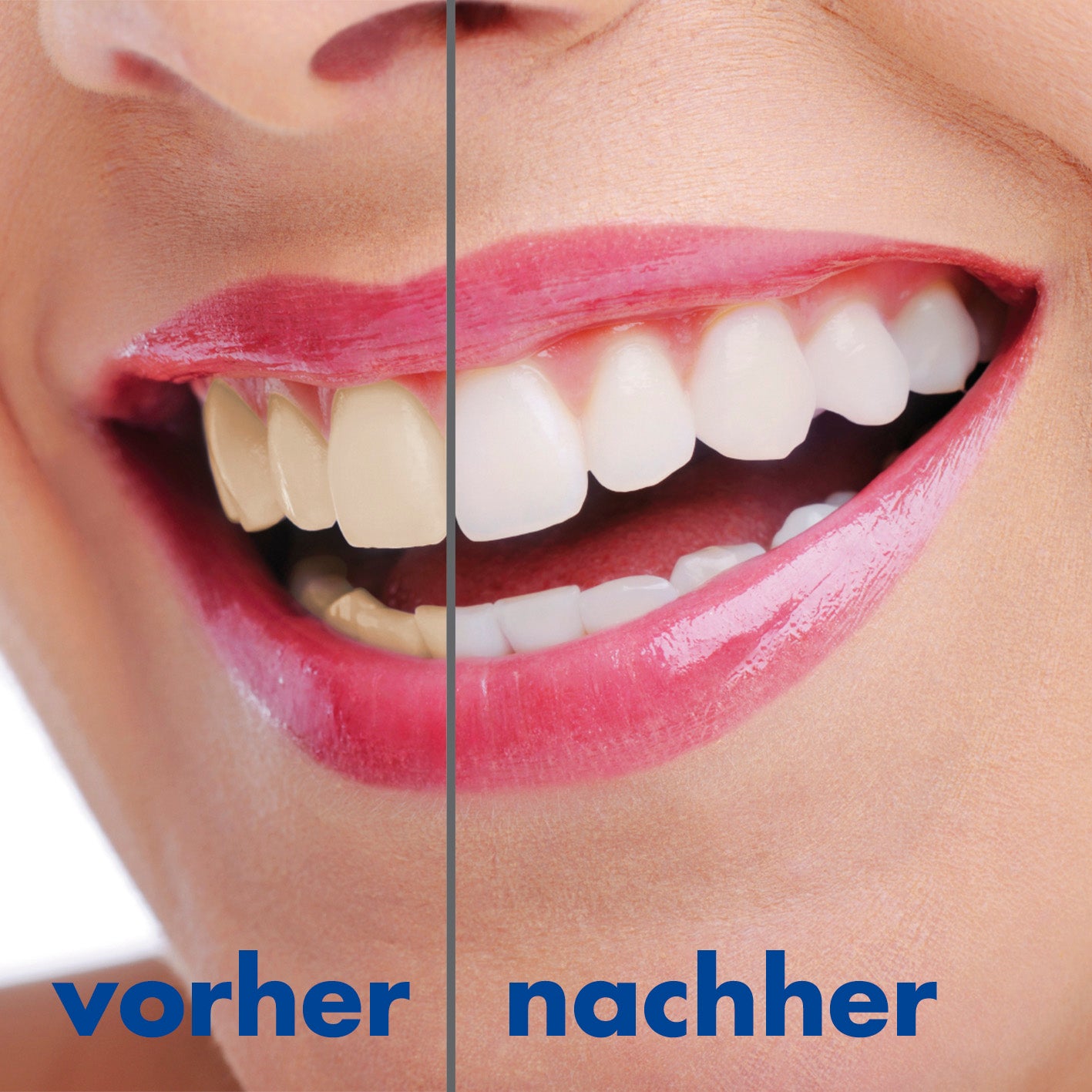 Schall-Zahnbürste - 360°-Borsten - Mit Vibrationsfunktion